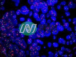 原位雜交FISH檢測(cè)正式實(shí)驗(yàn)（共聚焦拍照）